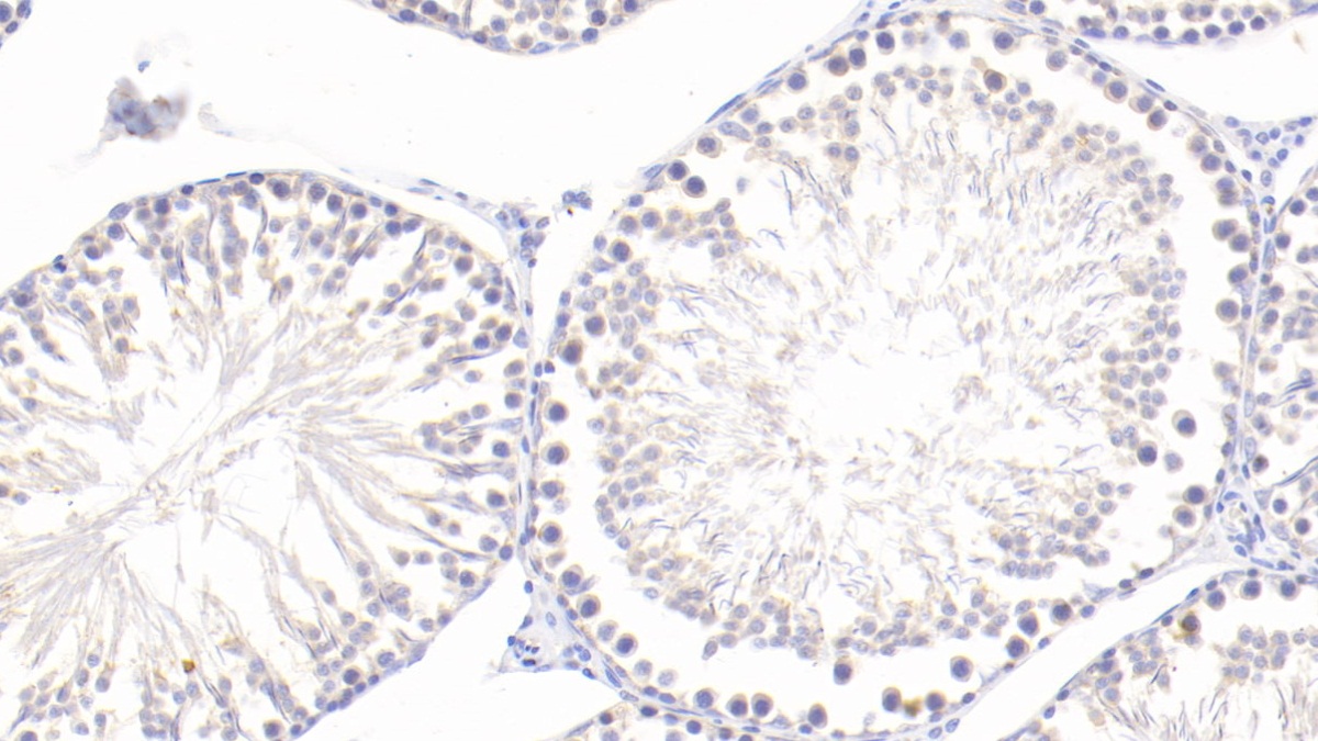 Polyclonal Antibody to Spondin 2 (SPON2)