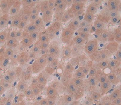 Polyclonal Antibody to Calcium Homeostasis Endoplasmic Reticulum Protein (CHERP)