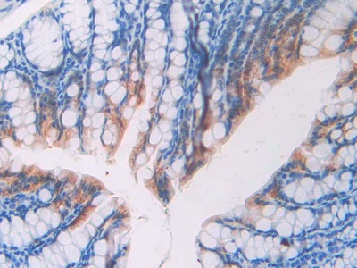 Polyclonal Antibody to Fibulin 4 (FBLN4)