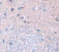 Polyclonal Antibody to Fibulin 3 (FBLN3)