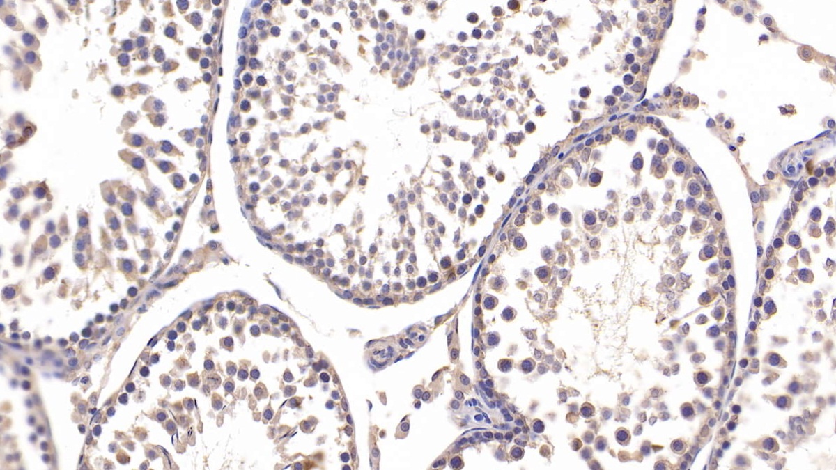 Polyclonal Antibody to Fibulin 3 (FBLN3)