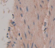 Polyclonal Antibody to F-Box Protein 32 (FBXO32)