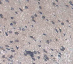 Polyclonal Antibody to Recoverin (RCVRN)