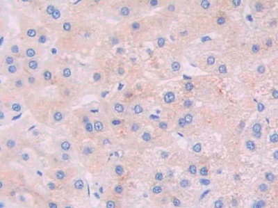 Polyclonal Antibody to Janus Kinase 2 (JAK2)