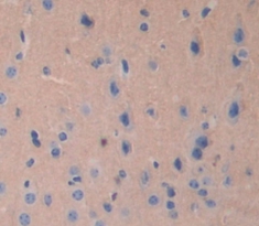 Polyclonal Antibody to Janus Kinase 2 (JAK2)