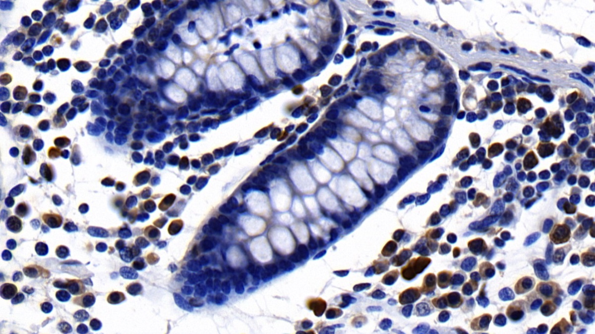 Polyclonal Antibody to Leukocyte Cell Derived Chemotaxin 2 (LECT2)