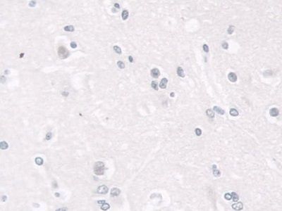 Polyclonal Antibody to Lamin B1 (LMNB1)