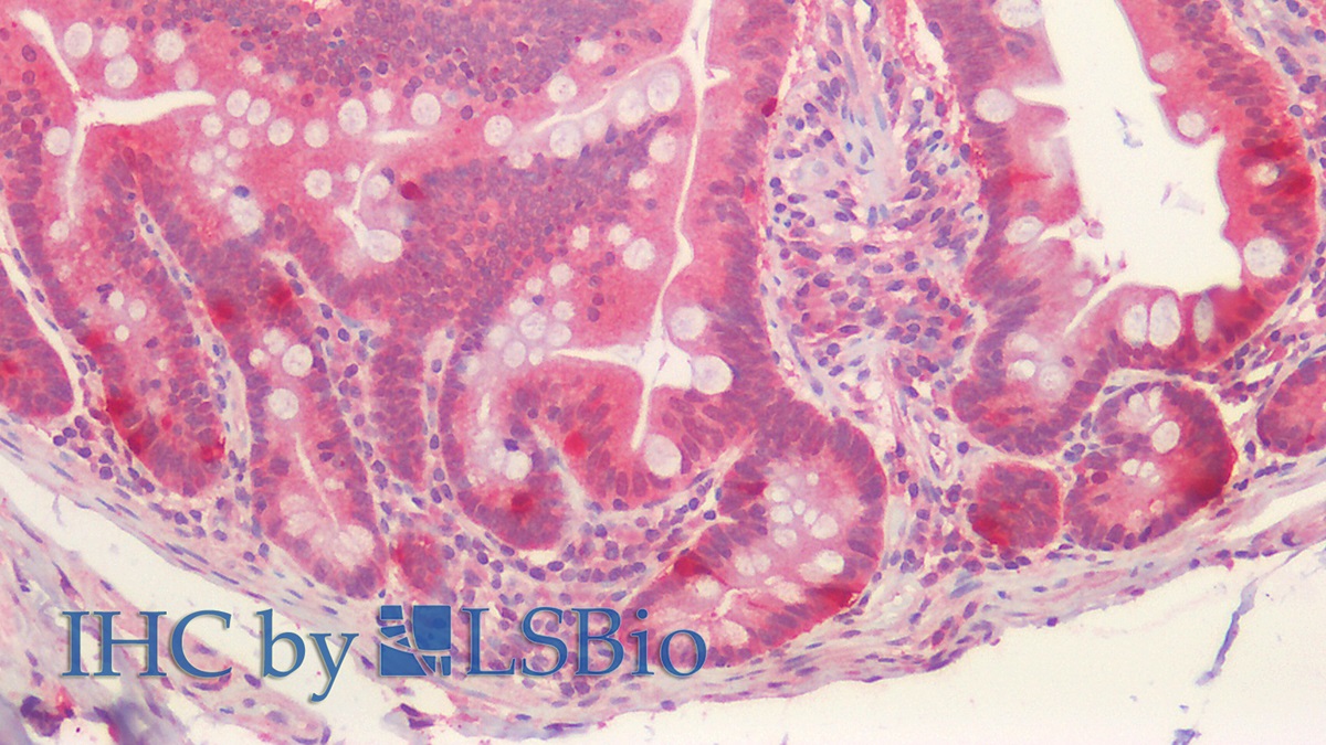 Polyclonal Antibody to Lysyl Oxidase Like Protein 1 (LOXL1)