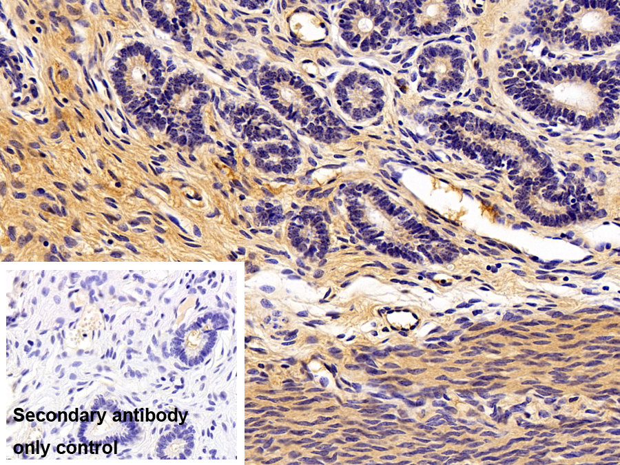 Polyclonal Antibody to Lysyl Oxidase Like Protein 1 (LOXL1)