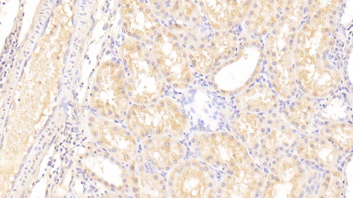 Polyclonal Antibody to Lysyl Oxidase Like Protein 3 (LOXL3)