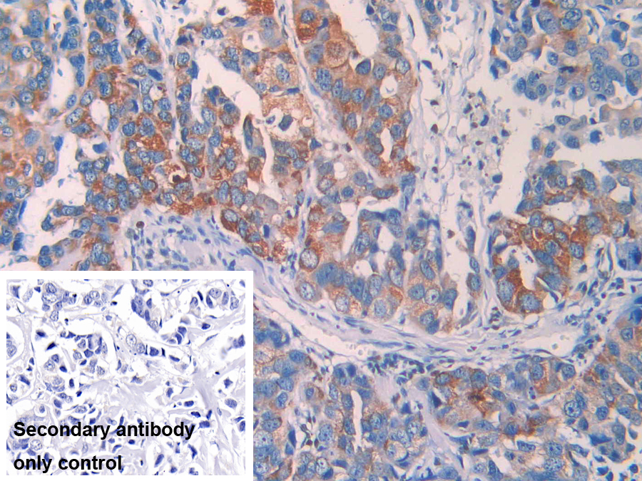 Polyclonal Antibody to Lysyl Oxidase Like Protein 4 (LOXL4)