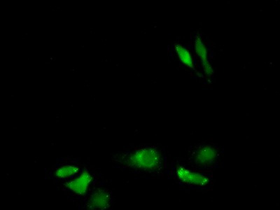 Polyclonal Antibody to Vesicle Associated Membrane Protein Associated Protein A (VAPA)