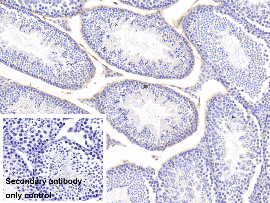 Polyclonal Antibody to Microfibrillar Associated Protein 5 (MFAP5)