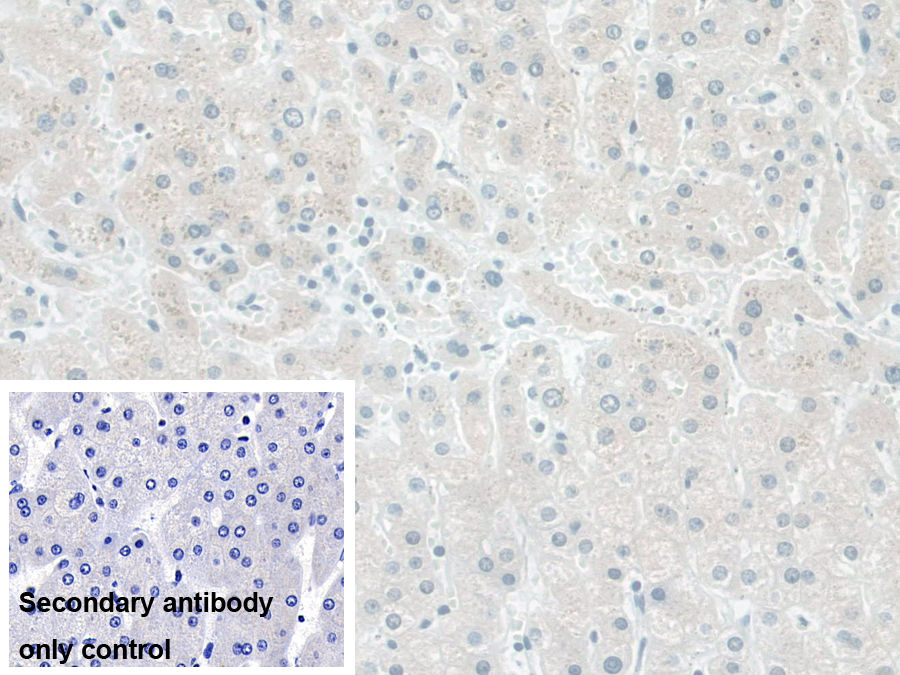 Polyclonal Antibody to Phosphodiesterase 1A, Calmodulin Dependent (PDE1A)