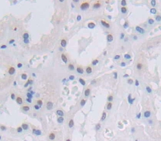 Polyclonal Antibody to Nuclear Factor I/B (NFIB)