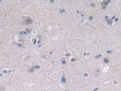 Polyclonal Antibody to 2',5'-Oligoadenylate Synthetase 2 (OAS2)