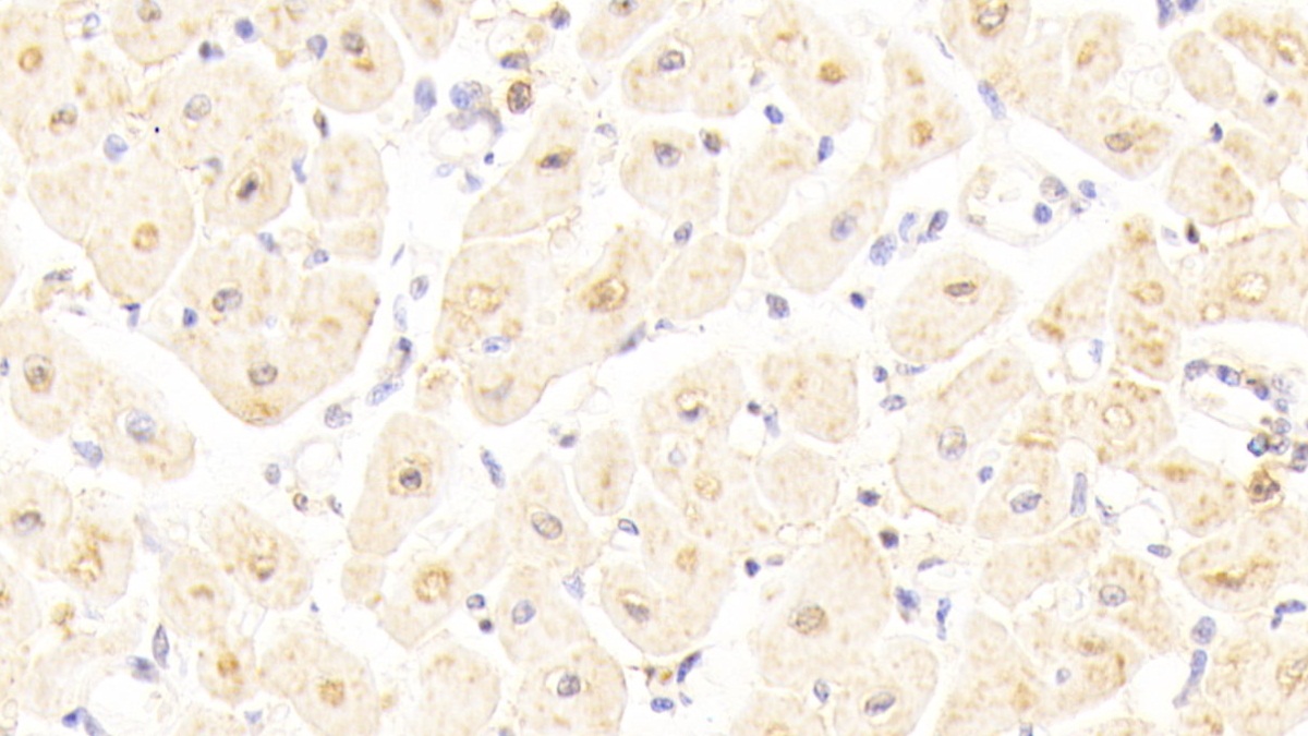 Polyclonal Antibody to Phosphoglucomutase 5 (PGM5)