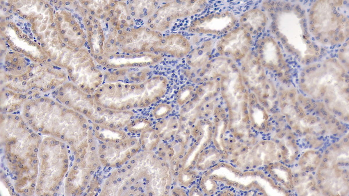 Polyclonal Antibody to Peroxiredoxin 3 (PRDX3)