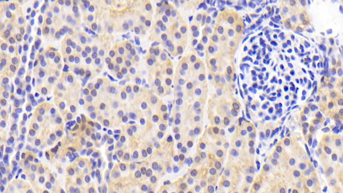 Polyclonal Antibody to Peroxiredoxin 4 (PRDX4)