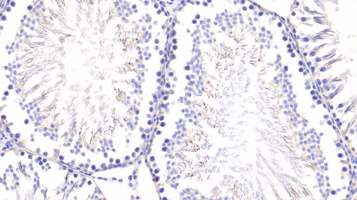 Polyclonal Antibody to Peroxiredoxin 2 (PRDX2)