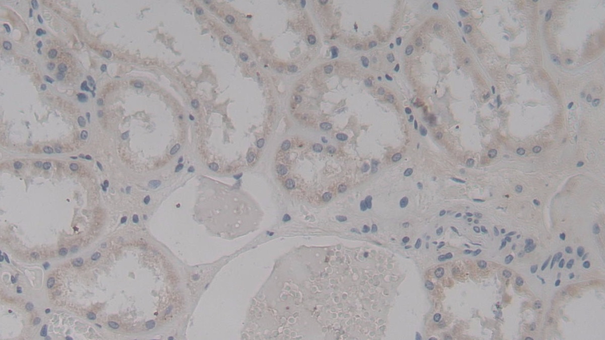 Polyclonal Antibody to Transgelin 2 (TAGLN2)