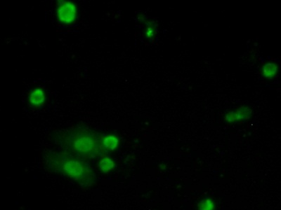 Polyclonal Antibody to Tumor Necrosis Factor Alpha Induced Protein 3 Interacting Protein 2 (TNIP2)