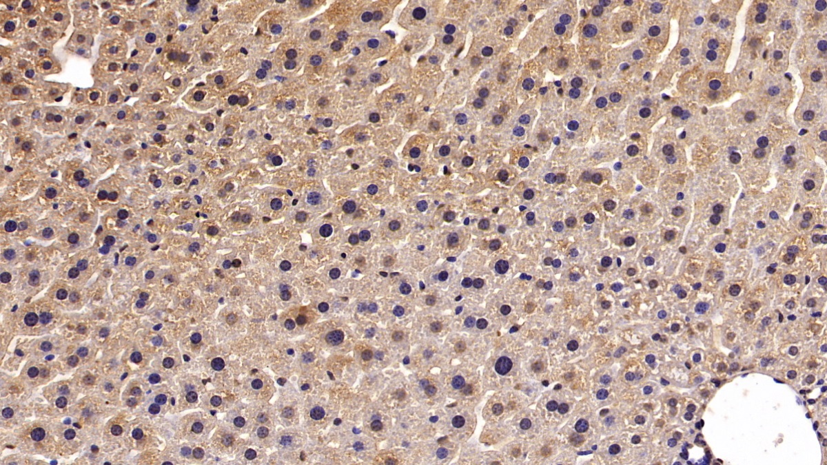 Polyclonal Antibody to Transient Receptor Potential Cation Channel Subfamily M, Member 4 (TRPM4)