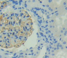 Polyclonal Antibody to Transient Receptor Potential Cation Channel Subfamily V, Member 1 (TRPV1)