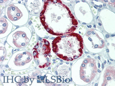 Polyclonal Antibody to Transient Receptor Potential Cation Channel Subfamily C, Member 6 (TRPC6)