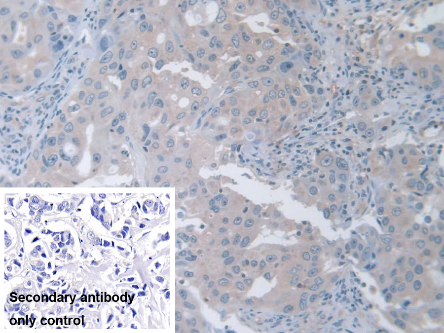 Polyclonal Antibody to Transient Receptor Potential Cation Channel Subfamily V, Member 3 (TRPV3)