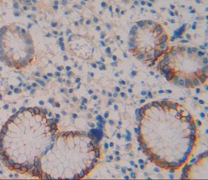 Polyclonal Antibody to Transient Receptor Potential Cation Channel Subfamily V, Member 6 (TRPV6)