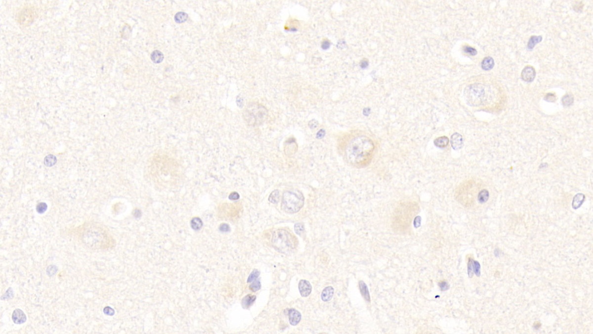 Polyclonal Antibody to Twisted Gastrulation Protein Homolog 1 (TWSG1)