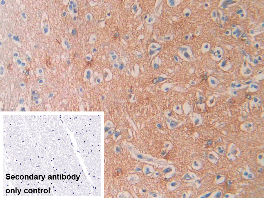 Polyclonal Antibody to Septin 5 (SEPT5)