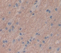 Polyclonal Antibody to Secreted Frizzled Related Protein 4 (SFRP4)