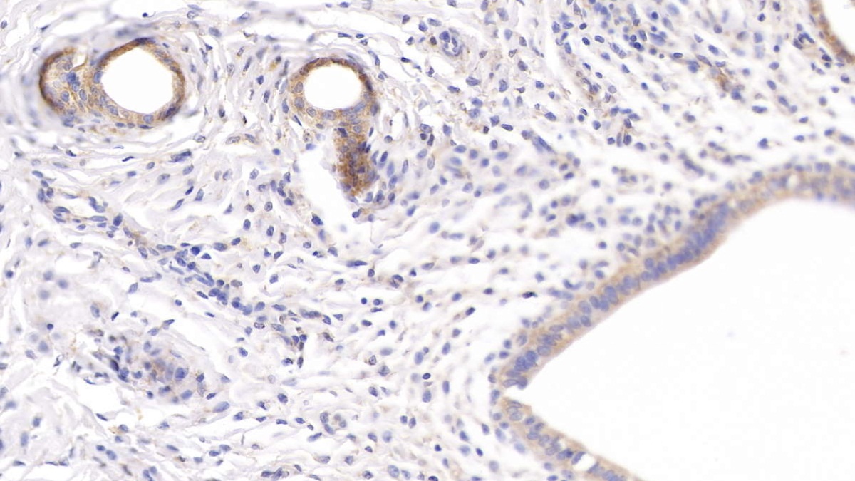 Polyclonal Antibody to Secreted Frizzled Related Protein 1 (SFRP1)