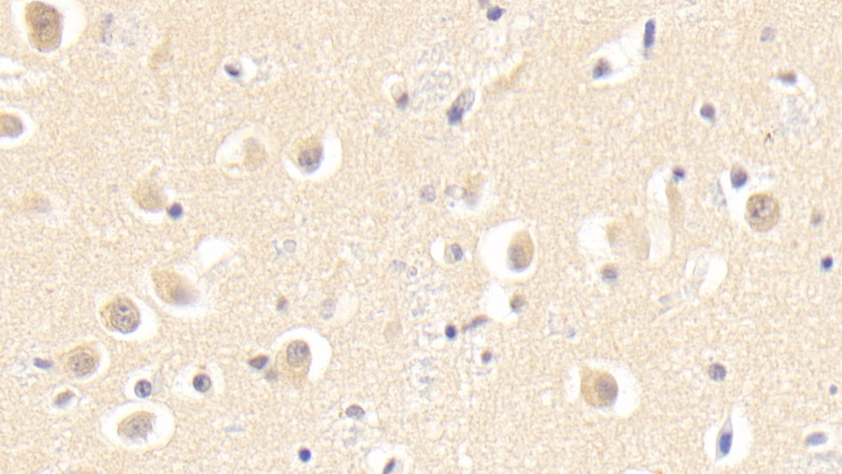 Polyclonal Antibody to S-Phase Kinase Associated Protein 1 (SKP1)