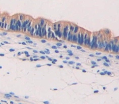 Polyclonal Antibody to Syncoilin (SYNC)