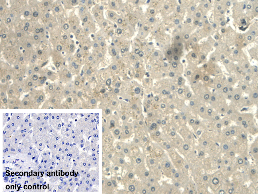 Polyclonal Antibody to Calmodulin Like Protein 3 (CALML3)