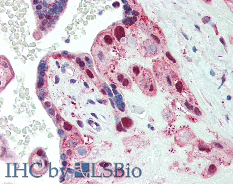 Polyclonal Antibody to Spectrin Beta, Non Erythrocytic 4 (SPTbN4)