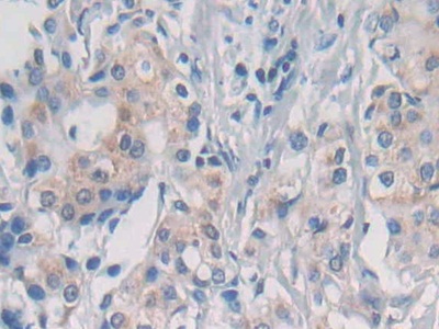 Polyclonal Antibody to Nesprin 1 (Nesp1)