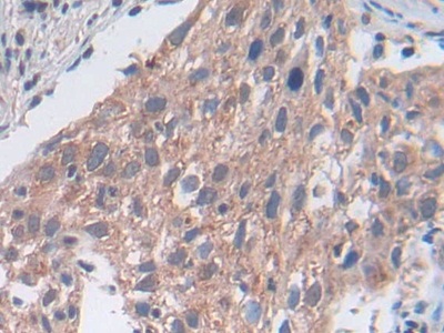 Polyclonal Antibody to Utrophin (UTRN)