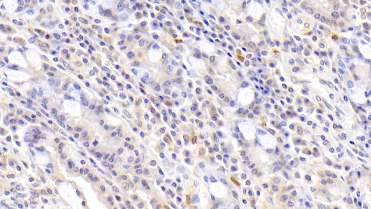 Polyclonal Antibody to Protoporphyrinogen Oxidase (PPOX)