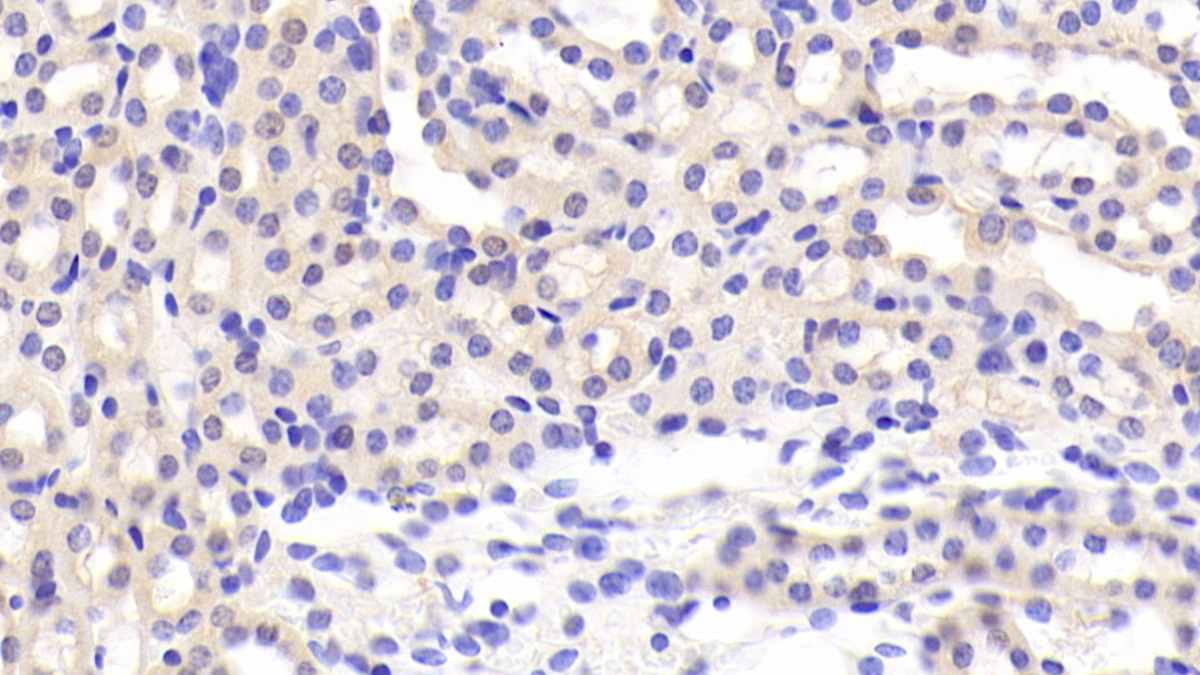 Polyclonal Antibody to Methylthioadenosine Phosphorylase (MTAP)