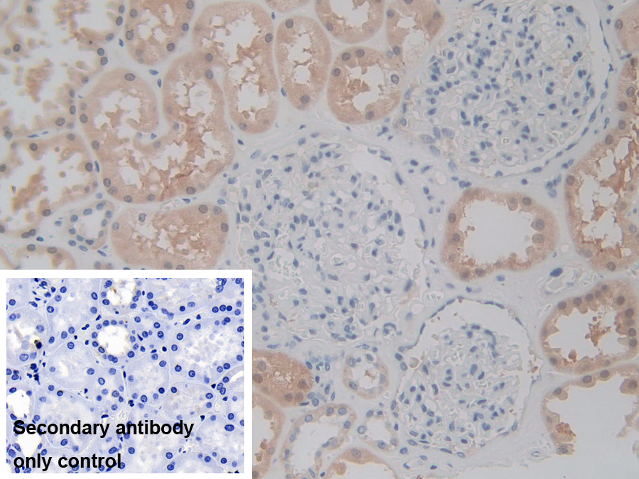 Polyclonal Antibody to Purinergic Receptor P2X, Ligand Gated Ion Channel 7 (P2RX7)