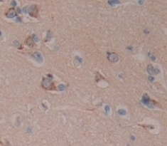 Polyclonal Antibody to Amyloid Beta Precursor Like Protein 1 (APLP1)