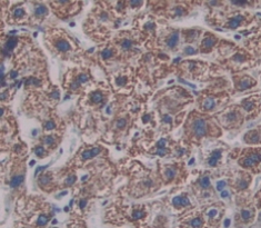 Polyclonal Antibody to Aspartate Beta Hydroxylase (ASPH)