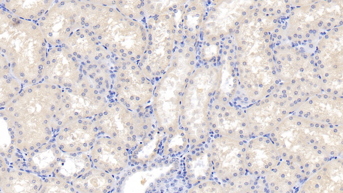 Polyclonal Antibody to Aspartate Beta Hydroxylase (ASPH)