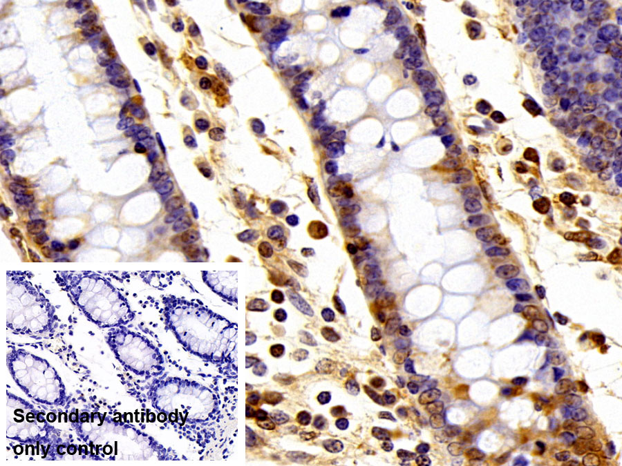 Polyclonal Antibody to Small Ubiquitin Related Modifier Protein 2 (SUMO2)