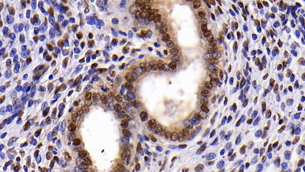 Polyclonal Antibody to Ubiquitin Like Modifier Activating Enzyme 2 (UBA2)