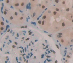 Polyclonal Antibody to Oxidative Stress Induced Growth Inhibitor 1 (OSGIN1)